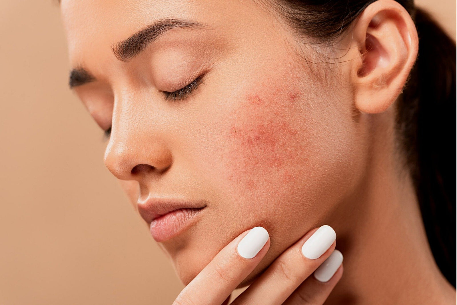 CLEARING BLEMISHES VIDEO / SKIN ALPHABET